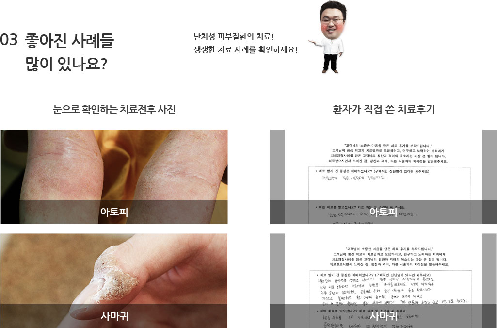 03 좋아진 사례들 많이 있나요? - 난치성 피부질환의 치료! 생생한 치료 사례를 확인하세요!