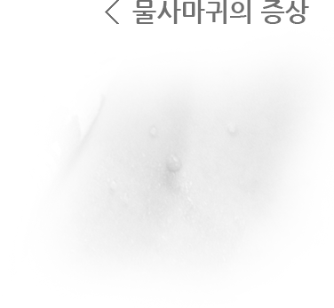 물사마귀의 증상