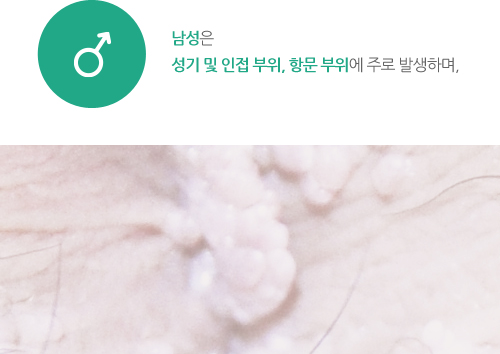 남성은 성기 및 인접 부위, 항문 부위에 주로 발생하며,