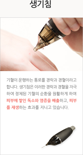 생기약침: 생기약침은 순수한 한약재에서 추출한 약액을 개인의 체질과 증상에 따라 약액을 경락과 경혈에 주입하여 환부의 증상 개선 및 피부 재생의 효과를 지니고 있습니다.