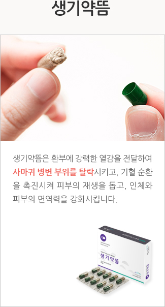 생기약뜸: 생기약뜸은 환부에 강력한 열감을 전달하여 사마귀 병변 부위를 탈락시키고, 기혈 순환 을 촉진시켜 피부의 재생을 돕고, 인체와 피부의 면역력을 강화시킵니다.